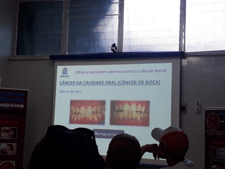 Saúde alerta sobre câncer de boca