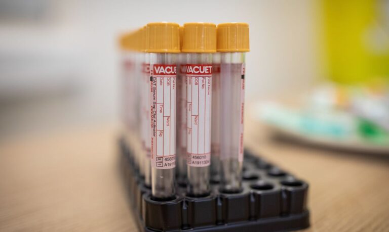 Brasil registra 552 óbitos e 30.476 novos casos da covid-19