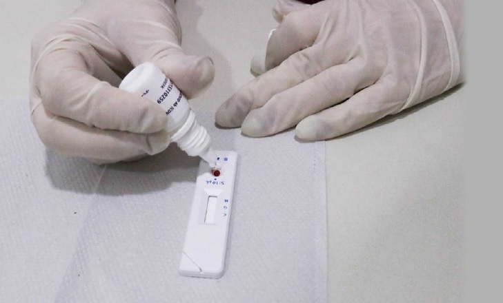 Saiba a diferença entre PCR, teste-rápido e sorologia para detecção da covid-19