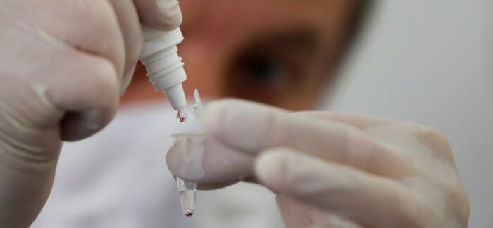 Inteligência artificial pode desafogar sistema de saúde na pandemia