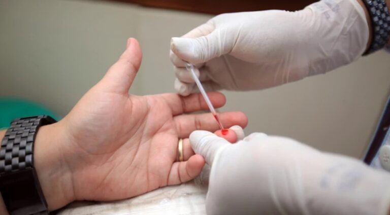 40 anos da epidemia do HIV: estudo de vacina busca voluntários no Brasil