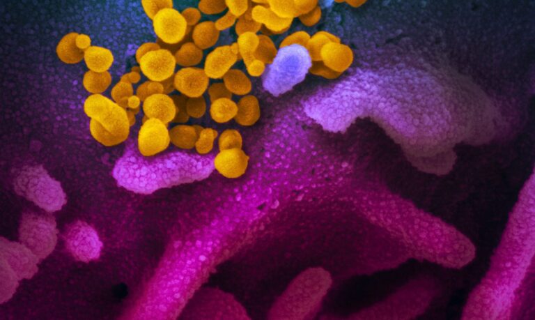 Fiocruz e Harvard explicam em estudo inflamação excessiva da covid-19