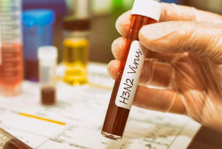 Sobe para 29 o número de óbitos provocados pelo vírus H3N2