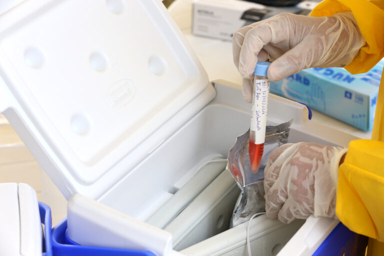 Aracaju registra primeiro caso de dupla infecção de coronavírus e influenza