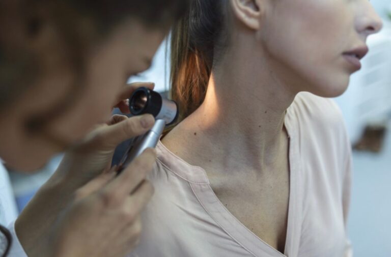 Sergipe deve ter mais de dois mil casos de câncer de pele não melanoma