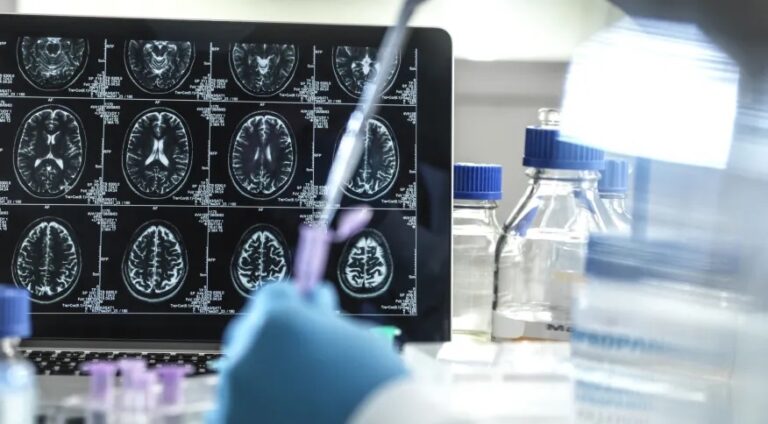 Proteína com ação antienvelhecimento combate inflamação e evita morte de neurônios