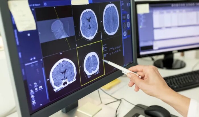 Pesquisa com pacientes terminais revela detalhes da experiência de “quase morte”