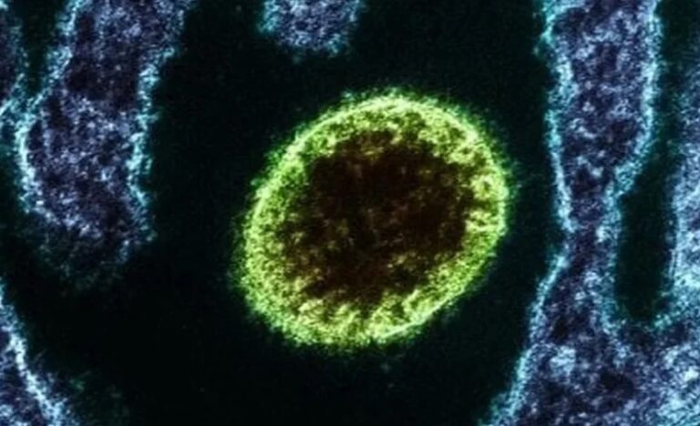 Nipah: vírus letal pode virar uma nova pandemia e chegar ao Brasil