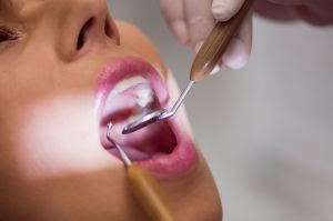 Câncer Bucal: dentista alerta sobre os principais sintomas da doença