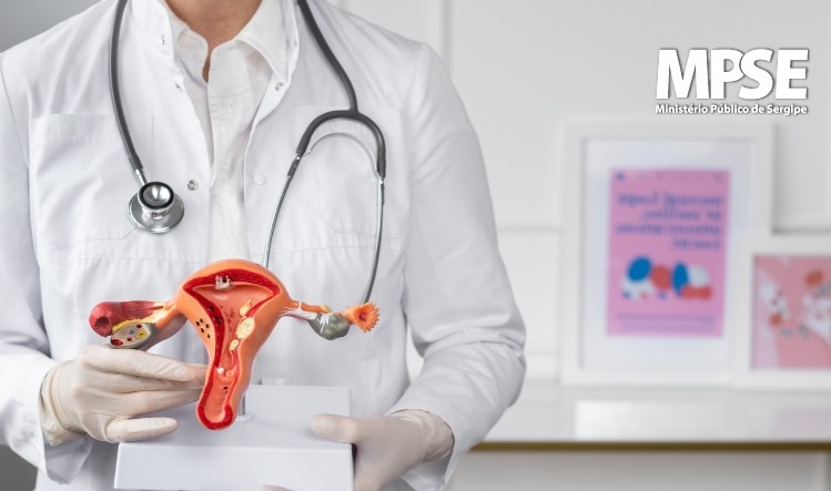 Audiência no MPSE discute atendimento a pacientes com endometriose profunda
