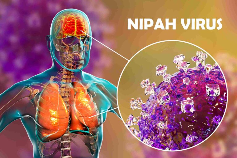 Nipah: sem cura, vírus que provoca inchaço no cérebro acende alerta