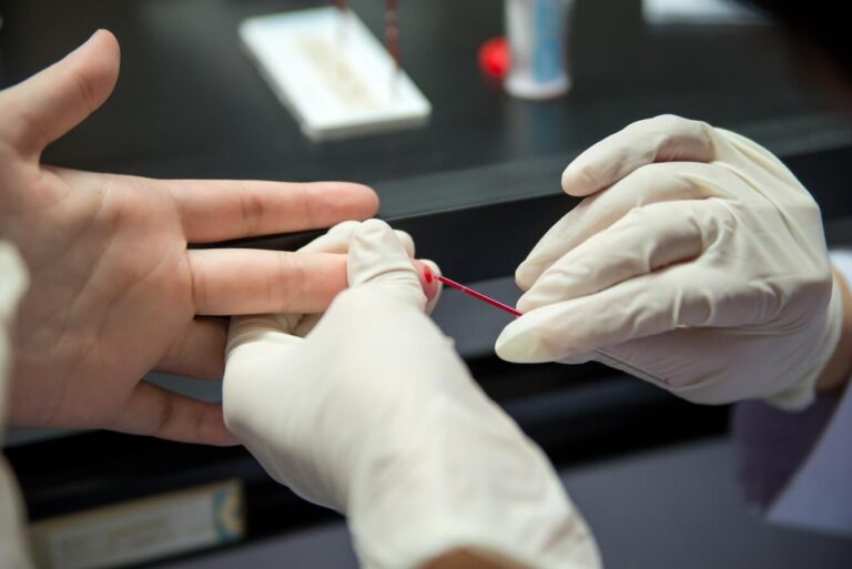 Ministério da Saúde orienta que farmácias realizem testes rápidos de HIV