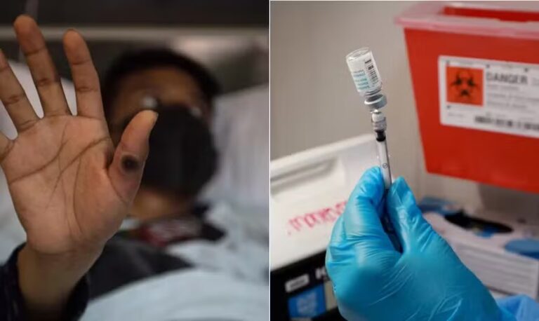 Mpox: em 3 pontos, o que a ciência ainda não sabe sobre o novo surto