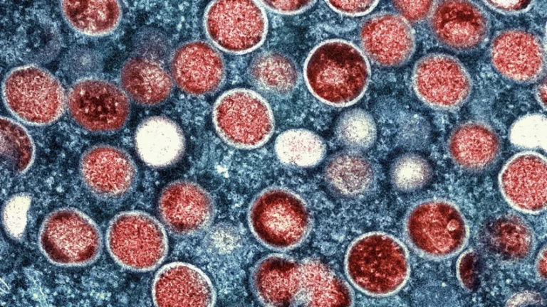 Mpox: vacina brasileira está prestes a realizar testes em humanos