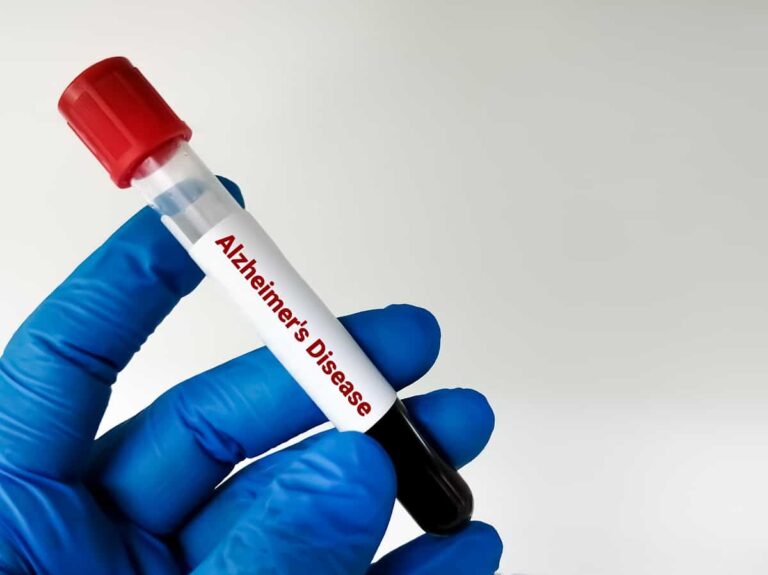 Um simples exame de sangue poderá identificar Alzheimer? Saiba mais