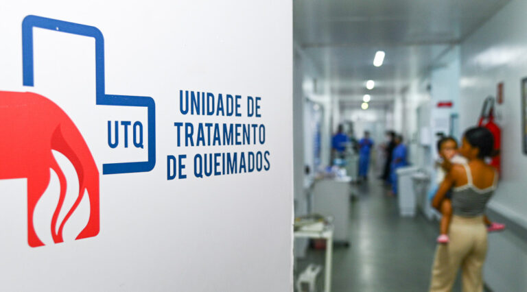 Huse registra 16 atendimentos de queimadura somente na primeira quinzena de junho