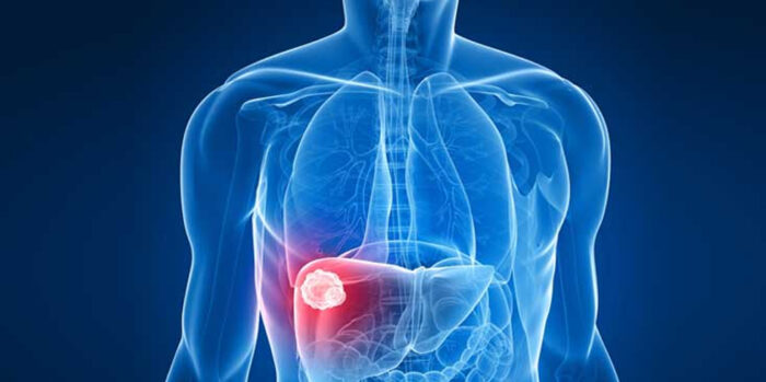 Brasil registra alta em casos de Hepatite A após uma década de recuo