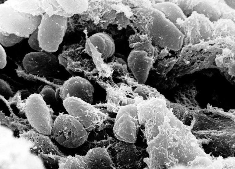 Cientistas resolvem mistério de 1,5 mil anos e acham a origem da 1ª pandemia do mundo