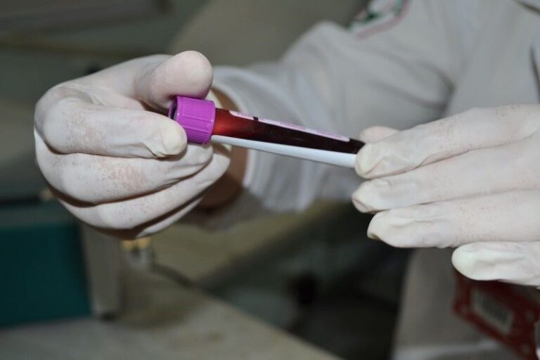 Hemose intensifica conscientização sobre cadastro de doadores de medula óssea