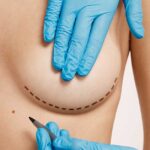 Outubro Rosa: câncer de mama é o tumor mais incidente entre mulheres no Brasil, aponta estimativa