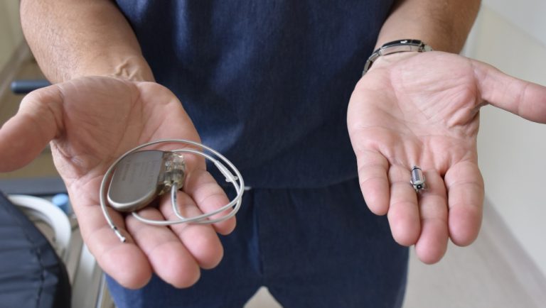 Entenda como funciona um marcapasso implantado no corpo