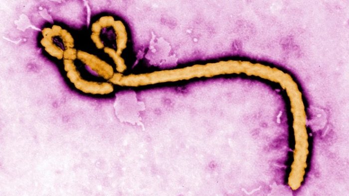 Paciente com suspeita de Ebola é internado em São Paulo
