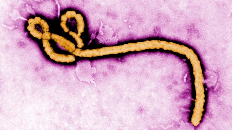 Paciente com suspeita de Ebola é internado em São Paulo