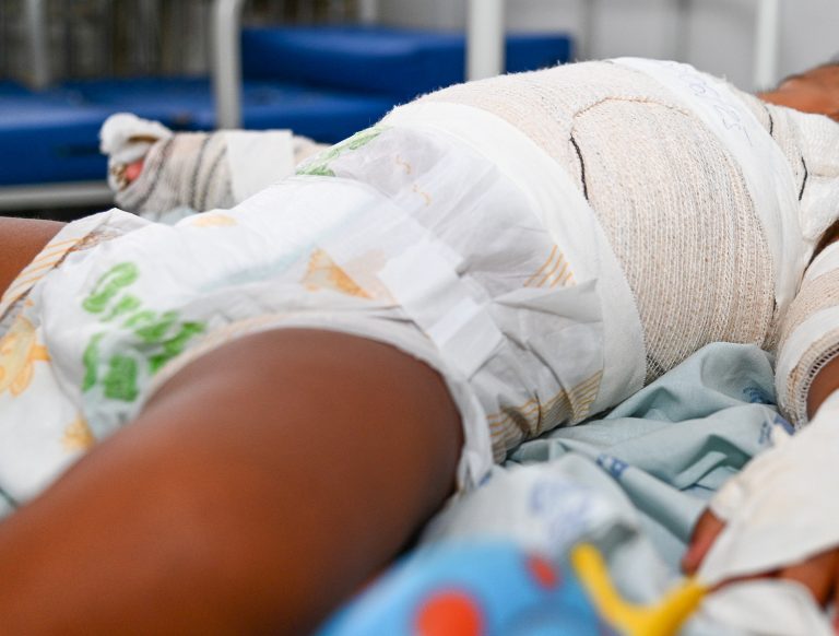Queimaduras por fogos de artifício já levaram nove pacientes à internação no Huse