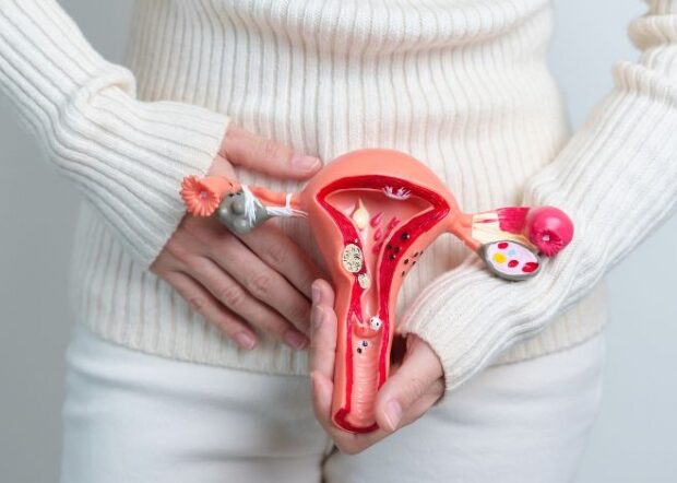 Planos de saúde terão de cobrir DIU hormonal a pacientes com endometriose a partir de outubro
