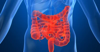 Em 13 anos, doença inflamatória intestinal cresce cinco vezes no Brasil