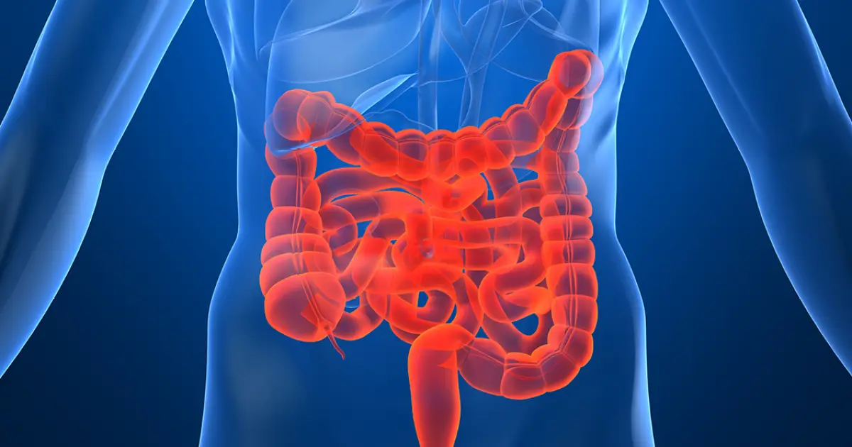 Em 13 anos, doença inflamatória intestinal cresce cinco vezes no Brasil