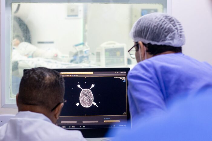 Huse realiza biópsia cerebral de alta precisão em criança de 3 anos