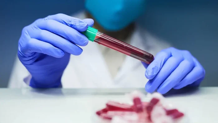 Novo exame de sangue que pode identificar 50 tipos de câncer chega ao Brasil