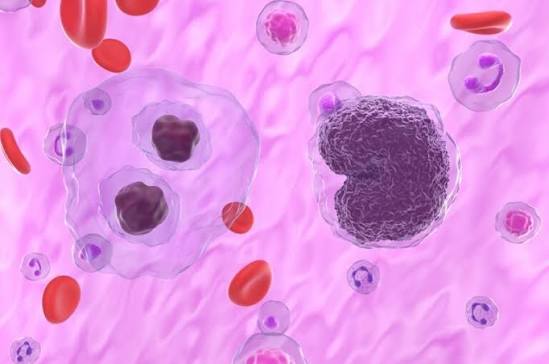 Linfoma não Hodgkin: Inca prevê 12 mil casos por ano deste tipo de câncer no Brasil