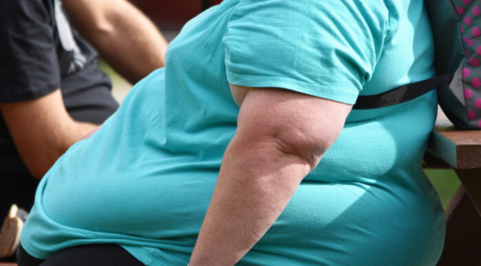 Em Aracaju, obesidade atinge 24,9% da população masculina e 25,1% da feminina