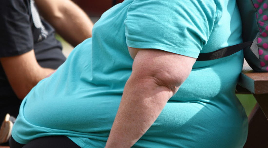 Em Aracaju, obesidade atinge 24,9% da população masculina e 25,1% da feminina
